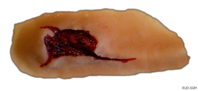 (blutendesbein.jpg)