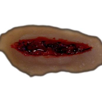 Platzwunde 2