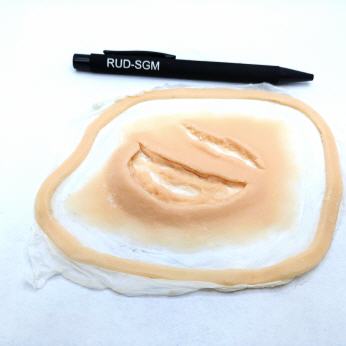 Risswunde