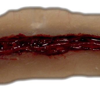 Schnittwunde mit gezackter Klinge