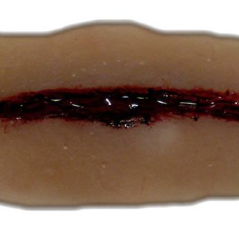 Schnittwunde mit gezackter Klinge 2