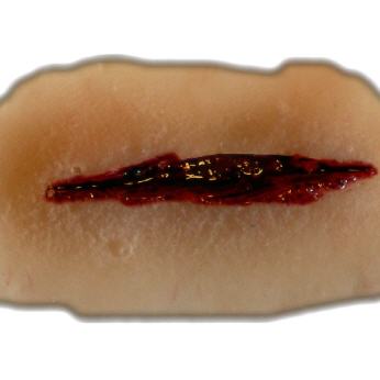 Stichwunde mit zweischneidiger Klinge