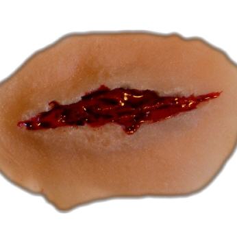 Stichwunde mit beidseits gezackter Klinge