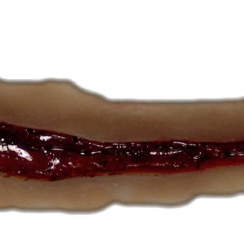 Schnittwunde gro&szlig;