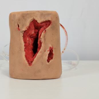 Woundpacking-to-go